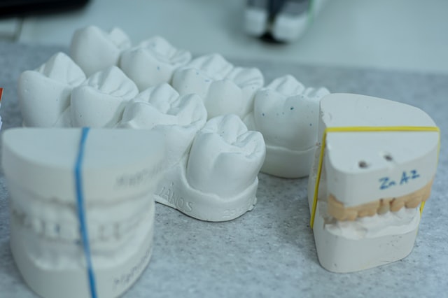 Modelo de dientes en ortodoncia