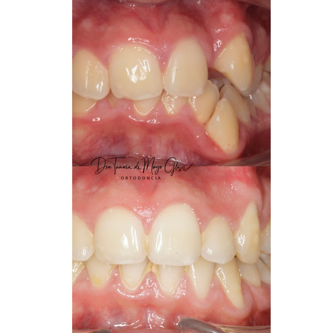 resultados ortodoncia